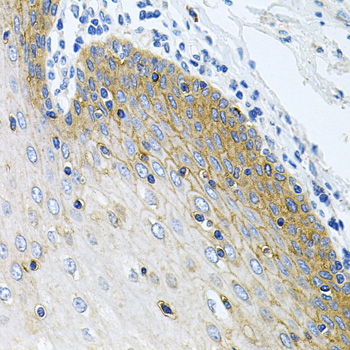 GLCNE / GNE Antibody - Immunohistochemistry of paraffin-embedded human esophagus.