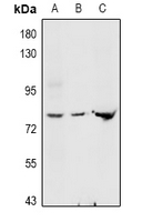 GLCNE / GNE Antibody - Western blot analysis of GNE expression in LO2 (A), mouse liver (B), rat liver (C) whole cell lysates.