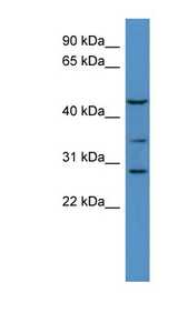 GLCT2 / B3GALT2 Antibody - B3GALT2 antibody Western blot of Mouse Brain lysate. This image was taken for the unconjugated form of this product. Other forms have not been tested.