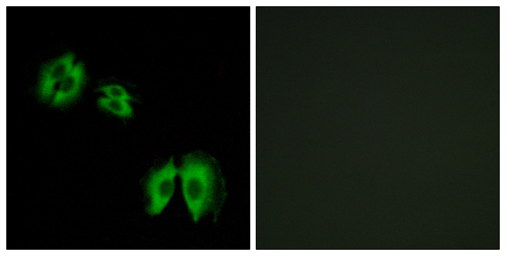 GLCT2 / B3GALT2 Antibody - Immunofluorescence analysis of A549 cells, using B3GALT2 Antibody. The picture on the right is blocked with the synthesized peptide.