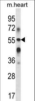 GLCT2 / B3GALT2 Antibody - B3GALT2 Antibody western blot of mouse heart tissue lysates (35 ug/lane). The B3GALT2 antibody detected the B3GALT2 protein (arrow).