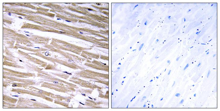 GLCT2 / B3GALT2 Antibody - Peptide - + Immunohistochemistry analysis of paraffin-embedded human heart tissue using B3GALT2 antibody.