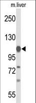 GLDC Antibody - Western blot of GLDC Antibody in mouse liver tissue lysates (35 ug/lane). GLDC (arrow) was detected using the purified antibody.