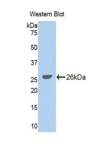 GLDC Antibody - Western blot of recombinant GLDC.  This image was taken for the unconjugated form of this product. Other forms have not been tested.