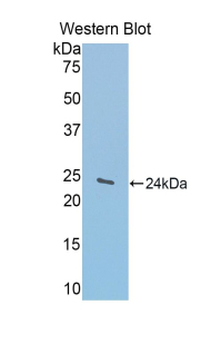 GLDC Antibody - Western blot of recombinant GLDC.  This image was taken for the unconjugated form of this product. Other forms have not been tested.