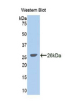 GLDC Antibody - Western blot of recombinant GLDC.  This image was taken for the unconjugated form of this product. Other forms have not been tested.