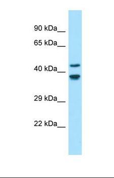GLDN / Gliomedin Antibody - Western blot of Human Fetal Brain. GLDN antibody dilution 1.0 ug/ml.  This image was taken for the unconjugated form of this product. Other forms have not been tested.