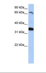GLE1 Antibody - Placenta lysate. Antibody concentration: 1.0 ug/ml. Gel concentration: 12%.  This image was taken for the unconjugated form of this product. Other forms have not been tested.