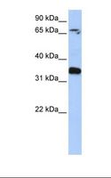 GLE1 Antibody - Placenta lysate. Antibody concentration: 1.0 ug/ml. Gel concentration: 12%.  This image was taken for the unconjugated form of this product. Other forms have not been tested.