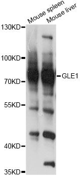 GLE1 Antibody - Western blot analysis of extracts of various cell lines, using GLE1 antibody at 1:3000 dilution. The secondary antibody used was an HRP Goat Anti-Rabbit IgG (H+L) at 1:10000 dilution. Lysates were loaded 25ug per lane and 3% nonfat dry milk in TBST was used for blocking. An ECL Kit was used for detection and the exposure time was 1s.