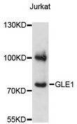 GLE1 Antibody - Western blot analysis of extracts of Jurkat cells, using GLE1 antibody at 1:3000 dilution. The secondary antibody used was an HRP Goat Anti-Rabbit IgG (H+L) at 1:10000 dilution. Lysates were loaded 25ug per lane and 3% nonfat dry milk in TBST was used for blocking. An ECL Kit was used for detection and the exposure time was 1s.