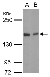 GLG1 / MG160 Antibody - Sample (30 ug of whole cell lysate) A: NT2D1 B: SK-N-SH 5% SDS PAGE GLG1 antibody diluted at 1:1000