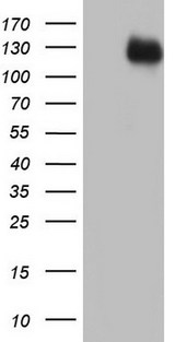 GLI / GLI1 Antibody - HEK293T cells were transfected with the pCMV6-ENTRY control (Left lane) or pCMV6-ENTRY GLI1 (Right lane) cDNA for 48 hrs and lysed. Equivalent amounts of cell lysates (5 ug per lane) were separated by SDS-PAGE and immunoblotted with anti-GLI1.