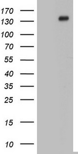 GLI / GLI1 Antibody - HEK293T cells were transfected with the pCMV6-ENTRY control (Left lane) or pCMV6-ENTRY GLI1 (Right lane) cDNA for 48 hrs and lysed. Equivalent amounts of cell lysates (5 ug per lane) were separated by SDS-PAGE and immunoblotted with anti-GLI1.