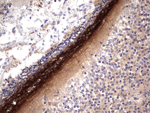 GLI / GLI1 Antibody - IHC of paraffin-embedded Human embryonic cerebellum using anti-GLI1 mouse monoclonal antibody. (Heat-induced epitope retrieval by 1 mM EDTA in 10mM Tris, pH8.5, 120°C for 3min).