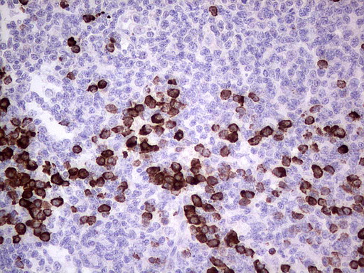GLI / GLI1 Antibody - Immunohistochemical staining of paraffin-embedded Human tonsil using anti-GLI1 mouse monoclonal antibody.  heat-induced epitope retrieval by 1 mM EDTA in 10mM Tris, pH8.0, 120C for 3min)