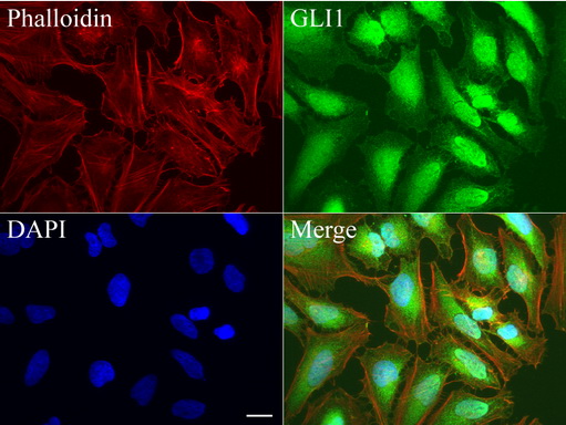 GLI / GLI1 Antibody - Immunofluorescent staining of HeLa cells using anti-GLI1 mouse monoclonal antibody  green, 1:50). Actin filaments were labeled with Alexa Fluor® 594 Phalloidin. (red), and nuclear with DAPI. (blue). Scale bar, 20µm.
