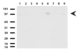 GLI / GLI1 Antibody - Western blot of cell lysates. (35ug) from 9 different cell lines. (1: HepG2, 2: HeLa, 3: SV-T2, 4: A549. 5: COS7, 6: Jurkat, 7: MDCK, 8: PC-12, 9: MCF7).