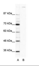 GLI / GLI1 Antibody - A: Marker, B: HepG2 Cell Lysate.  This image was taken for the unconjugated form of this product. Other forms have not been tested.