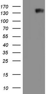 GLI / GLI1 Antibody - HEK293T cells were transfected with the pCMV6-ENTRY control. (Left lane) or pCMV6-ENTRY GLI1. (Right lane) cDNA for 48 hrs and lysed. Equivalent amounts of cell lysates. (5 ug per lane) were separated by SDS-PAGE and immunoblotted with anti-GLI1.