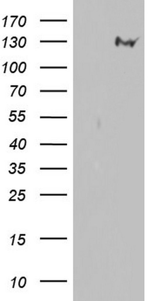 GLI / GLI1 Antibody - HEK293T cells were transfected with the pCMV6-ENTRY control (Left lane) or pCMV6-ENTRY GLI1 (Right lane) cDNA for 48 hrs and lysed. Equivalent amounts of cell lysates (5 ug per lane) were separated by SDS-PAGE and immunoblotted with anti-GLI1.