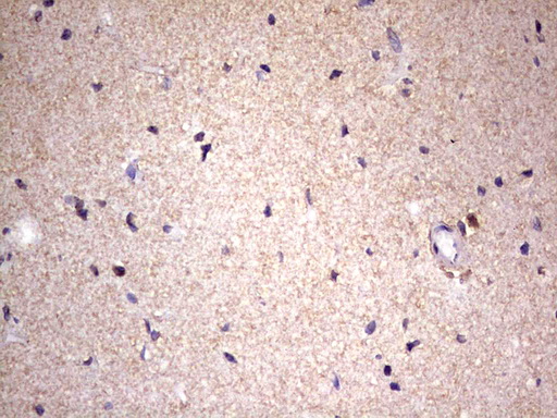 GLI / GLI1 Antibody - IHC of paraffin-embedded Human adult brain tissue using anti-GLI1 mouse monoclonal antibody. (Heat-induced epitope retrieval by 1 mM EDTA in 10mM Tris, pH8.5, 120°C for 3min).