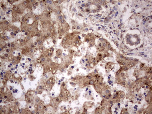 GLI / GLI1 Antibody - IHC of paraffin-embedded Human embryonic liver tissue using anti-GLI1 mouse monoclonal antibody. (Heat-induced epitope retrieval by 1 mM EDTA in 10mM Tris, pH8.5, 120°C for 3min).
