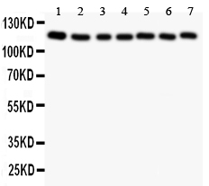 GLI / GLI1 Antibody - Western blot analysis of GLI2 using anti-GLI2 antibody. Electrophoresis was performed on a 5-20% SDS-PAGE gel at 70V (Stacking gel) / 90V (Resolving gel) for 2-3 hours. The sample well of each lane was loaded with 50ug of sample under reducing conditions. lane 1: U87 whole cell lysate, lane 2: MCF-7 whole cell lysate, lane 3: HELA whole cell lysate, lane 4: SKOV whole cell lysate, lane 5: HT1080 whole cell lysate, lane 6: COLO320 whole cell lysate, lane 7: HEPG2 whole cell lysate. After Electrophoresis, proteins were transferred to a Nitrocellulose membrane at 150mA for 50-90 minutes. Blocked the membrane with 5% Non-fat Milk/ TBS for 1.5 hour at RT. The membrane was incubated with rabbit anti-GLI2 antigen affinity purified polyclonal antibody at 0.5 µg/mL overnight at 4°C, then washed with TBS-0.1% Tween 3 times with 5 minutes each and probed with a goat anti-rabbit IgG-HRP secondary antibody at a dilution of 1:10000 for 1.5 hour at RT. The signal is developed using an Enhanced Chemiluminescent detection (ECL) kit with Tanon 5200 system. A specific band was detected for GLI2 at approximately 118KD. The expected band size for GLI2 is at 118KD.