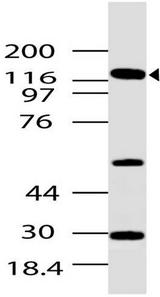 GLI / GLI1 Antibody - Fig-1: Western blot analysis of GLI1. Anti-GLI1 antibody was used at 4 µg/ml on Brain lysate.