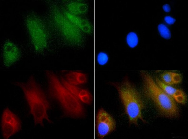 GLI / GLI1 Antibody - Immunocytochemistry/Immunofluorescence: Gli1 Antibody - Gli1 antibody was tested in HepG2 cells with FITC (green). Nuclei and actin were counterstained with DAPI (blue) and Phalloidin (red).  This image was taken for the unconjugated form of this product. Other forms have not been tested.