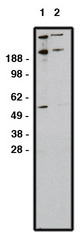 GLI / GLI1 Antibody - Western blot of GLI1 antibody on RMS-13 cell lysate. Lysate used at 15 ug/lane. Antibody used at 1:200 (lane 1) and 1:400 (lane 2) dilution. Secondary antibody, mouse anti-rabbit HRP, used at 1:75k dilution.