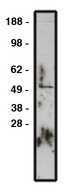 GLI / GLI1 Antibody - Western blot of GLI1 antibody on RMS-13 lysate. Lysate used at 15 ug/lane. Antibody used at 10 ug/ml. Secondary antibody, mouse anti-rabbit HRP, used at 1:200k dilution.