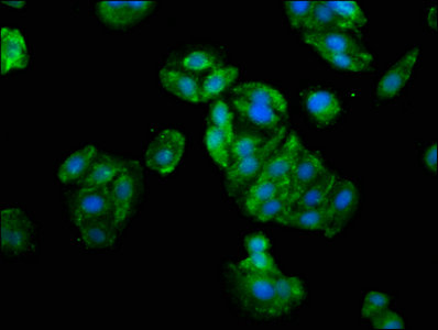 GLI / GLI1 Antibody - Immunofluorescence staining of HepG2 cells with GLI1 Antibody at 1:133, counter-stained with DAPI. The cells were fixed in 4% formaldehyde, permeabilized using 0.2% Triton X-100 and blocked in 10% normal Goat Serum. The cells were then incubated with the antibody overnight at 4°C. The secondary antibody was Alexa Fluor 488-congugated AffiniPure Goat Anti-Rabbit IgG(H+L).