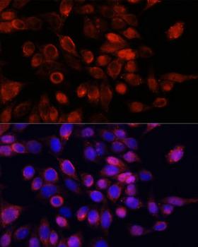 GLI / GLI1 Antibody - Immunofluorescence analysis of HeLa cells using GLI1 antibody at dilution of 1:100. Blue: DAPI for nuclear staining.