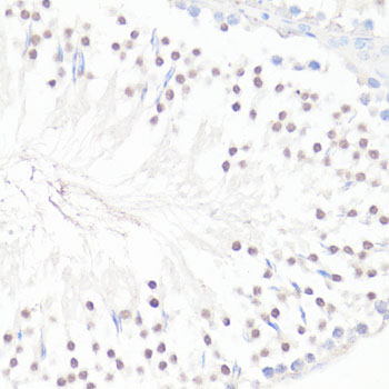 GLI / GLI1 Antibody - Immunohistochemistry of paraffin-embedded rat testis using GLI1 antibody at dilution of 1:100 (40x lens).