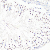 GLI / GLI1 Antibody - Immunohistochemistry of paraffin-embedded rat testis using GLI1 antibody at dilution of 1:100 (40x lens).