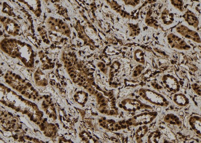 GLI / GLI1 Antibody - 1:100 staining human kidney tissue by IHC-P. The sample was formaldehyde fixed and a heat mediated antigen retrieval step in citrate buffer was performed. The sample was then blocked and incubated with the antibody for 1.5 hours at 22°C. An HRP conjugated goat anti-rabbit antibody was used as the secondary.