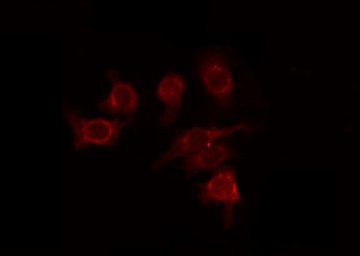 GLI / GLI1 Antibody - Staining HepG2 cells by IF/ICC. The samples were fixed with PFA and permeabilized in 0.1% Triton X-100, then blocked in 10% serum for 45 min at 25°C. The primary antibody was diluted at 1:200 and incubated with the sample for 1 hour at 37°C. An Alexa Fluor 594 conjugated goat anti-rabbit IgG (H+L) Ab, diluted at 1/600, was used as the secondary antibody.