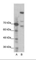 GLI / GLI1 Antibody - A: Marker, B: Jurkat Cell Lysate.  This image was taken for the unconjugated form of this product. Other forms have not been tested.