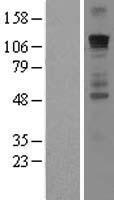 GLI / GLI1 Protein - Western validation with an anti-DDK antibody * L: Control HEK293 lysate R: Over-expression lysate