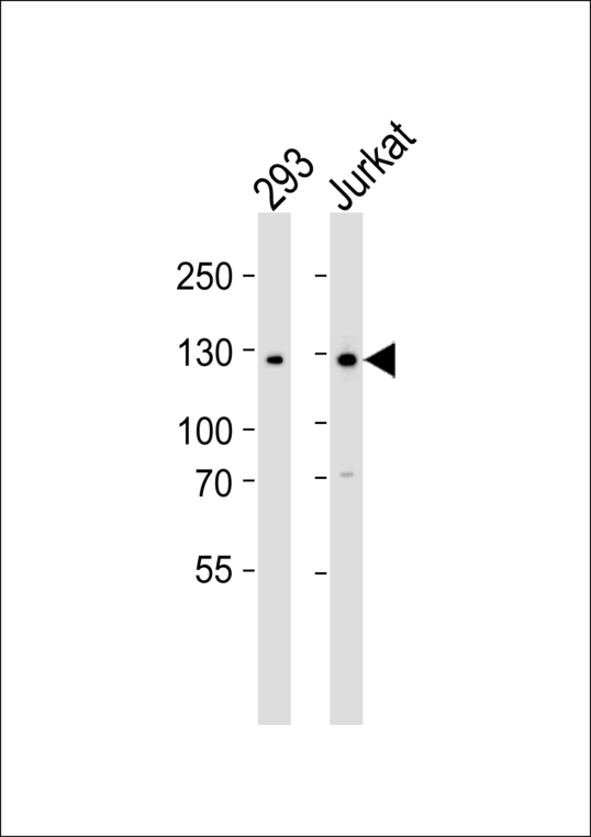 GLI2 Antibody - Western blot of lysates from 293, Jurkat cell line (from left to right) with GLI2 Antibody. Antibody was diluted at 1:1000 at each lane. A goat anti-rabbit IgG H&L (HRP) at 1:5000 dilution was used as the secondary antibody. Lysates at 35 ug per lane.