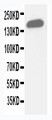 GLI2 Antibody - WB of GLI2 antibody. WB: Human Placenta Tissue Lysate.