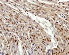 GLI2 Antibody - Immunohistochemistry: Gli2 Antibody - IHC analysis of Gli2 in mouse heart.  This image was taken for the unconjugated form of this product. Other forms have not been tested.