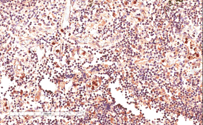 GLI2 Antibody - Goat Anti-GLI2 Antibody (4µg/ml) staining of paraffin embedded Human Lymph Node. Microwaved antigen retrieval with citrate buffer pH 6, HRP-staining.