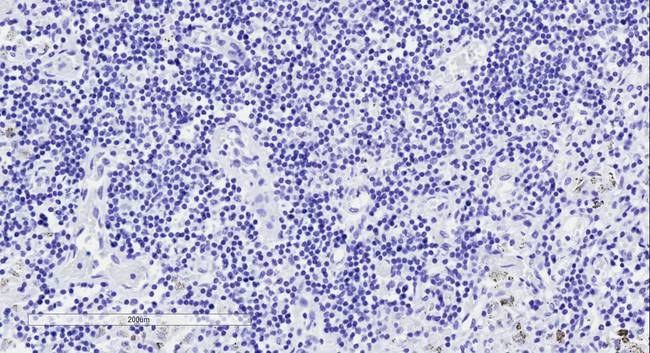 GLI2 Antibody - Goat Anti-GLI2 Antibody Negative Control showing staining of paraffin embedded Human Lymph Node, with no primary antibody.
