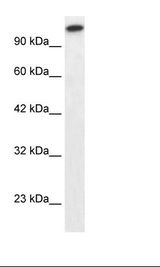 GLI2 Antibody - Jurkat Cell Lysate.  This image was taken for the unconjugated form of this product. Other forms have not been tested.