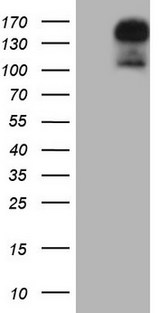 GLI2 Antibody - HEK293T cells were transfected with the pCMV6-ENTRY control. (Left lane) or pCMV6-ENTRY GLI2. (Right lane) cDNA for 48 hrs and lysed. Equivalent amounts of cell lysates. (5 ug per lane) were separated by SDS-PAGE and immunoblotted with anti-GLI2.