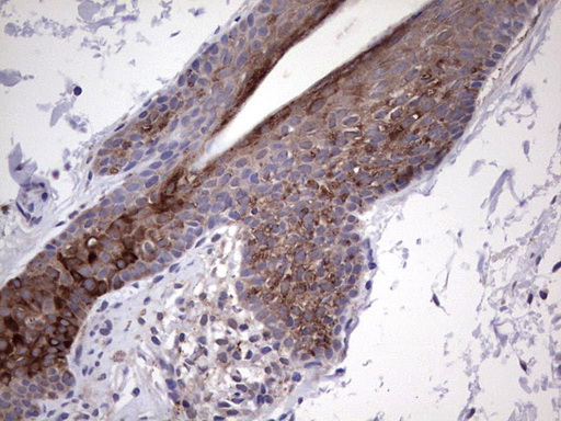 GLI2 Antibody - IHC of paraffin-embedded Human skin tissue using anti-GLI2 mouse monoclonal antibody. (Heat-induced epitope retrieval by 1 mM EDTA in 10mM Tris, pH8.5, 120°C for 3min).