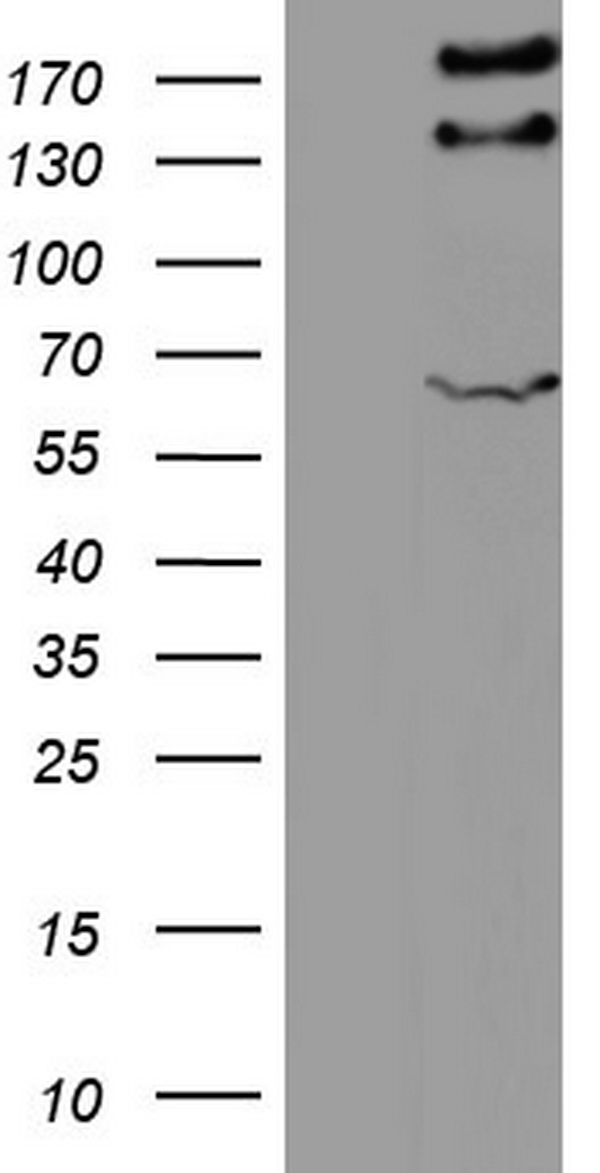 GLI2 Antibody - HEK293T cells were transfected with the pCMV6-ENTRY control (Left lane) or pCMV6-ENTRY GLI2 (Right lane) cDNA for 48 hrs and lysed. Equivalent amounts of cell lysates (5 ug per lane) were separated by SDS-PAGE and immunoblotted with anti-GLI2.