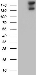 GLI2 Antibody - HEK293T cells were transfected with the pCMV6-ENTRY control. (Left lane) or pCMV6-ENTRY GLI2. (Right lane) cDNA for 48 hrs and lysed. Equivalent amounts of cell lysates. (5 ug per lane) were separated by SDS-PAGE and immunoblotted with anti-GLI2.